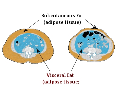 abdominal cross section
